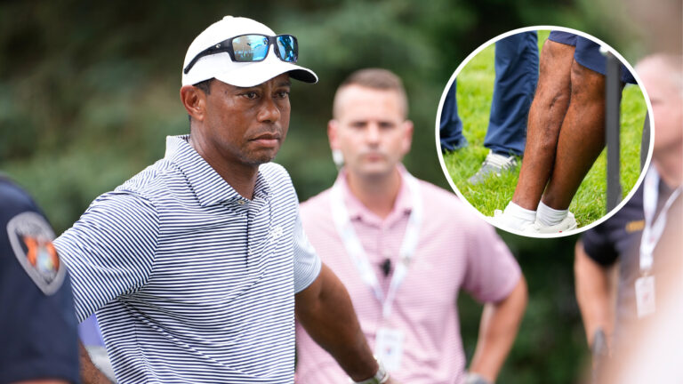 Tiger Woods injury